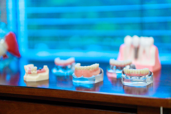 Sets of teeth models at Wheaton Oral Surgery in Naperville, IL