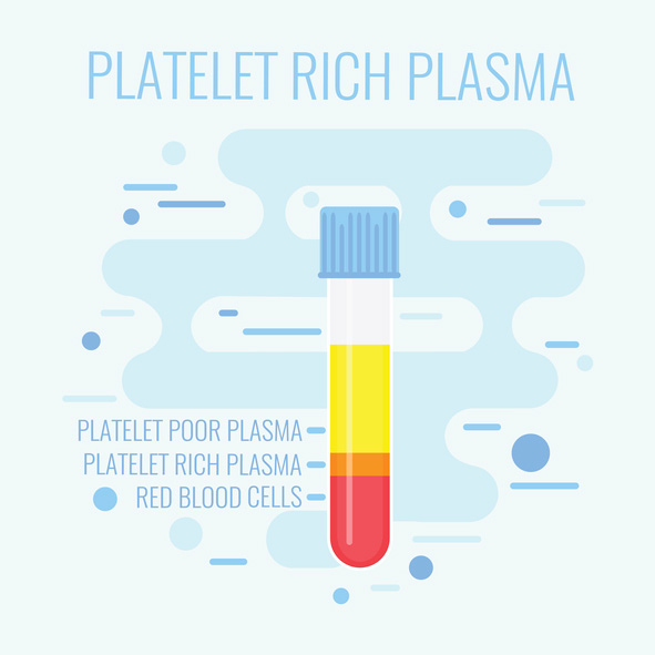 Illustration of a test tube filled with platelet rich plasma at Wheaton Oral Surgery in Naperville, IL