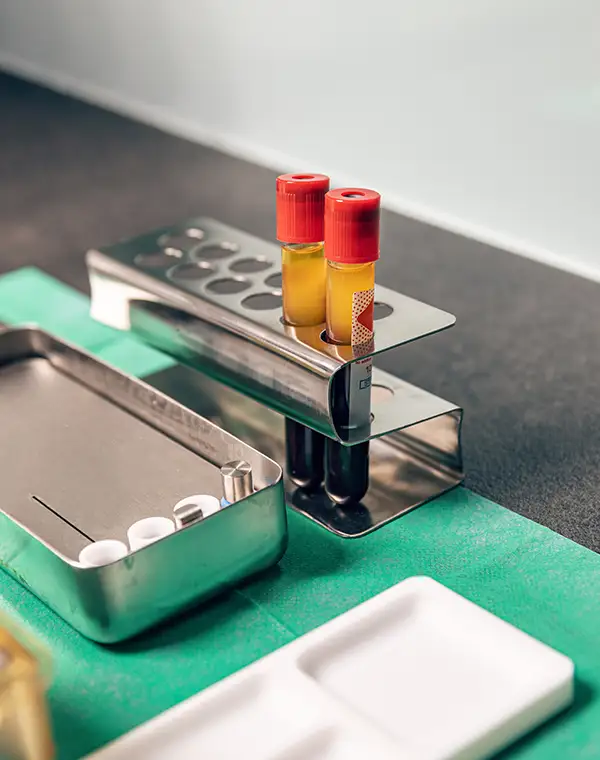 Blood sample tubes containing platelet-rich plasma in a lab setup, prepared for use in dental implant procedures.